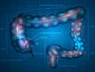 Καρκίνος του παχέος εντέρου: 4 τροφές που μειώνουν τον κίνδυνο